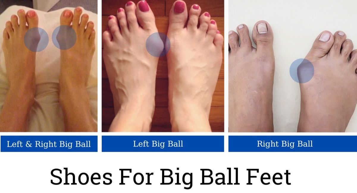 Shoes For Big Ball Feet